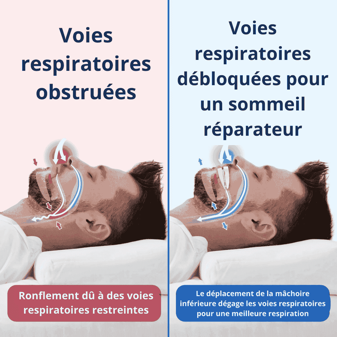 "SilenceNuit™ : Dites Adieu aux Ronflements pour des Nuits Paisibles !"