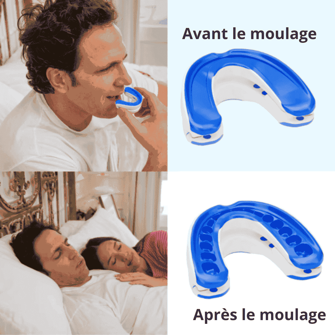 "SilenceNuit™ : Dites Adieu aux Ronflements pour des Nuits Paisibles !"